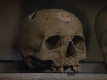 El cráneo de Nostradamus relacionado con el crimen de Julius