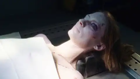 Malcom hace la autopsia a una mujer que muere por un fuerte golpe en la cabeza Neox