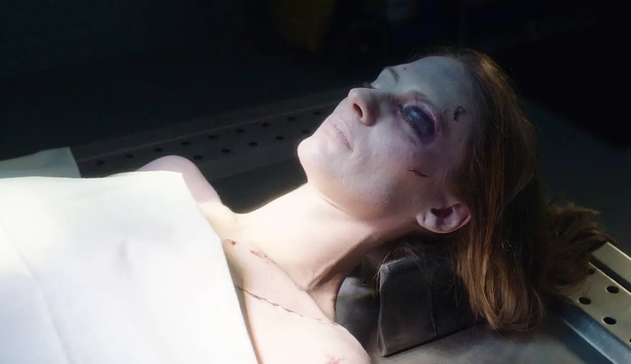 Malcom hace la autopsia a una mujer que muere por un fuerte golpe en la cabeza 